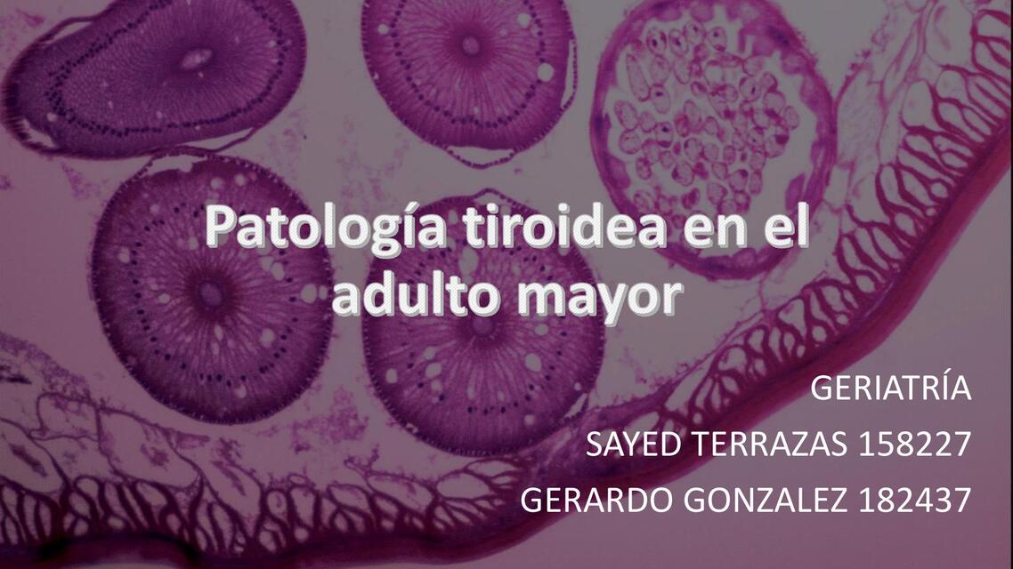 Tiroides Geriatrica