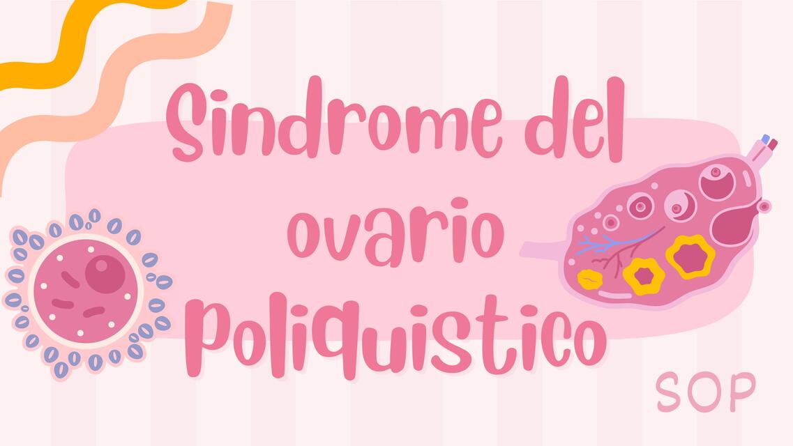 Sindrome del ovario poliquistico