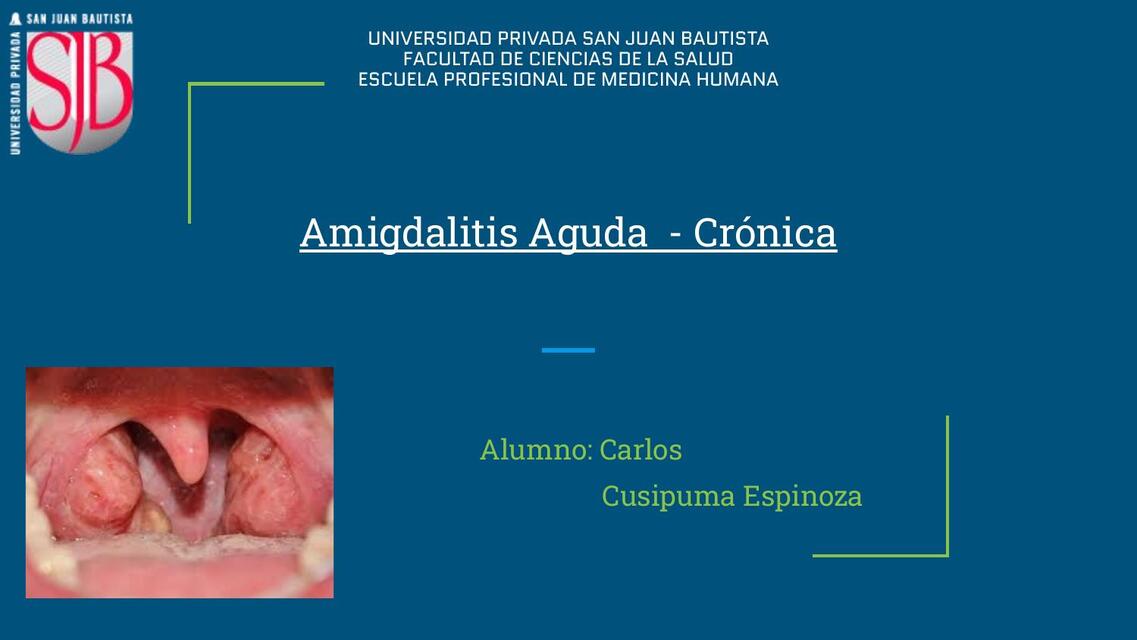 Amigdalitis