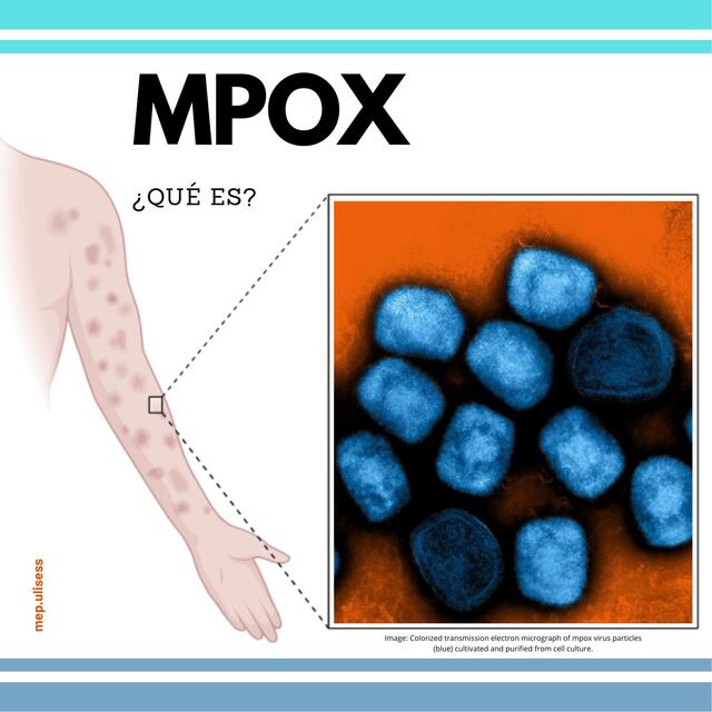 Virus MPOX