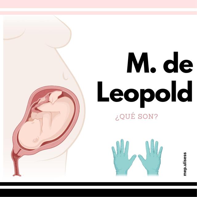 Maniobras de leopold