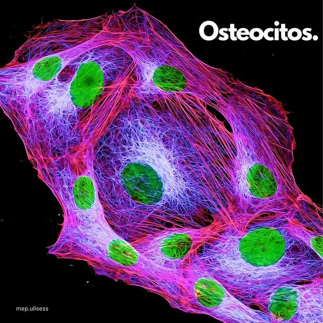 Osteosarcoma