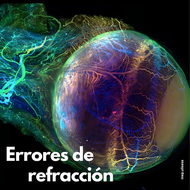 Errores de refracción