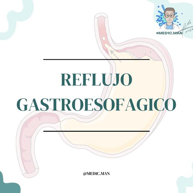 ENFERMEDAD DE REFLUJO GASTROESOFAGICO