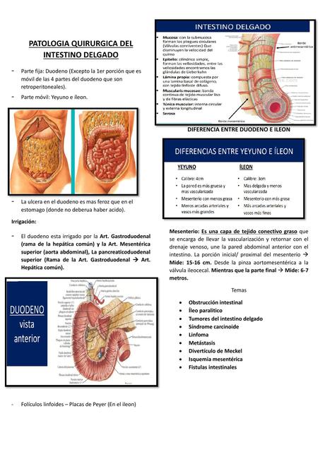 Patología quirúrgica del intestino delgado 