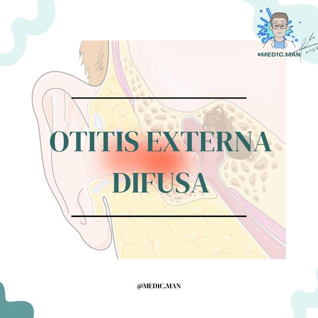 OTITIS EXTERNA DIFUSA