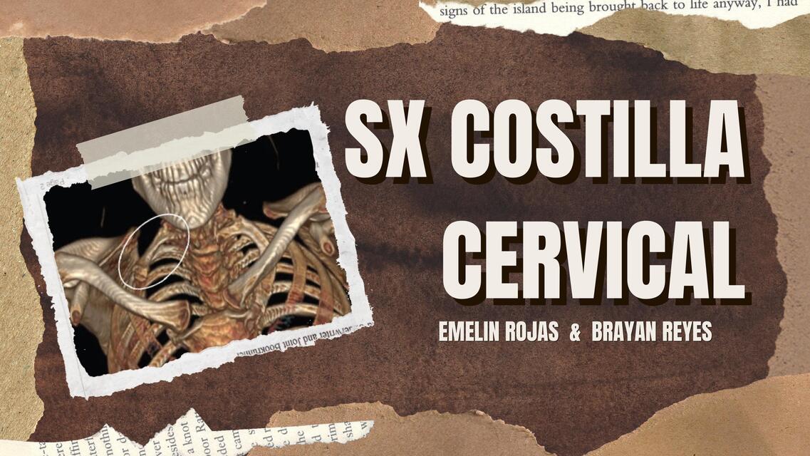 Sx de costilla cervical