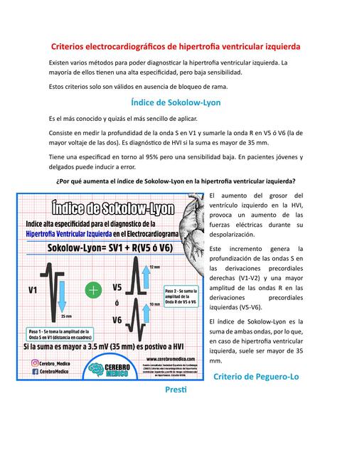 Criterios electrocardiográficos de hipertrofia ven