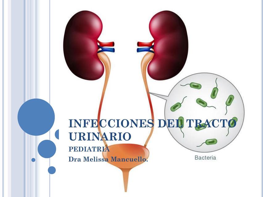 Infecciones del Tracto Urinario