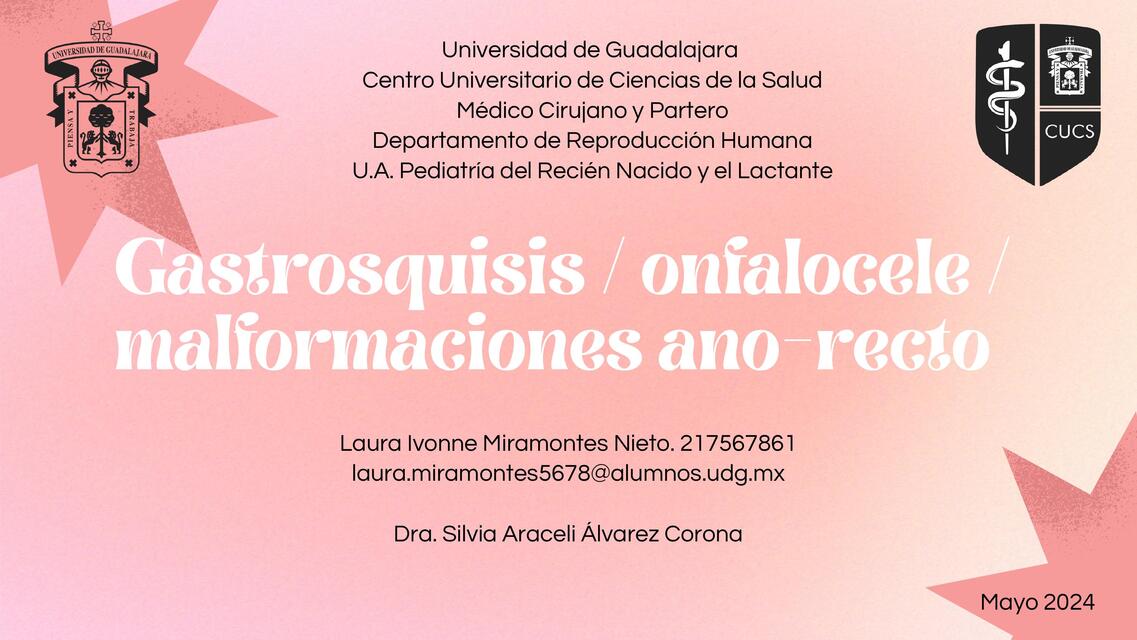 Gastrosquisis, onfalocele y malformaciones ano rec