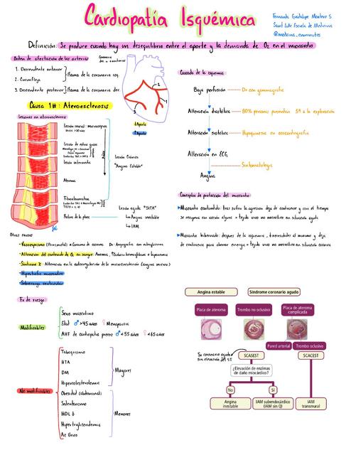 Cardiopatia isquemica