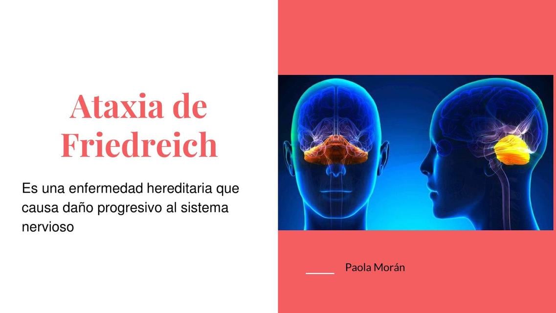 Ataxia De Friedreich Dra Tramadol UDocz ataxia-de-friedreich-dra-tramadol-udocz