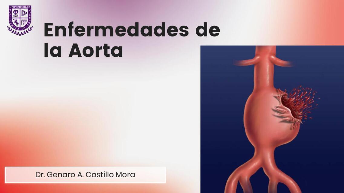 Enfermedades de la Aorta