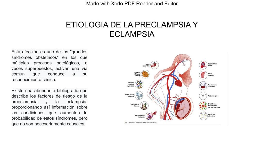 ETIOLOGIA PREECLAMSIA Y ECLAMPSIA