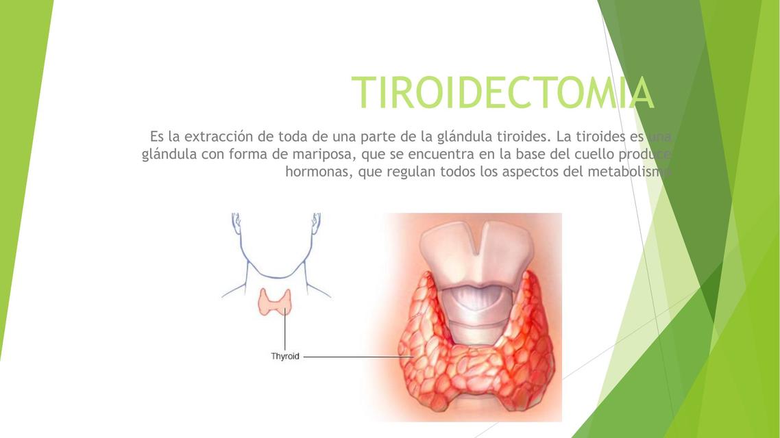 TIROIDECTOMIA Víctor Montes uDocz