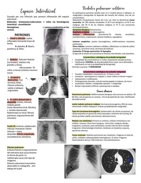 3 PA torax espacio intersticial patrones y Nodulos