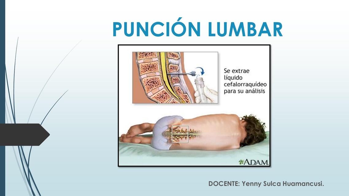 PUNCIÓN LUMBAR