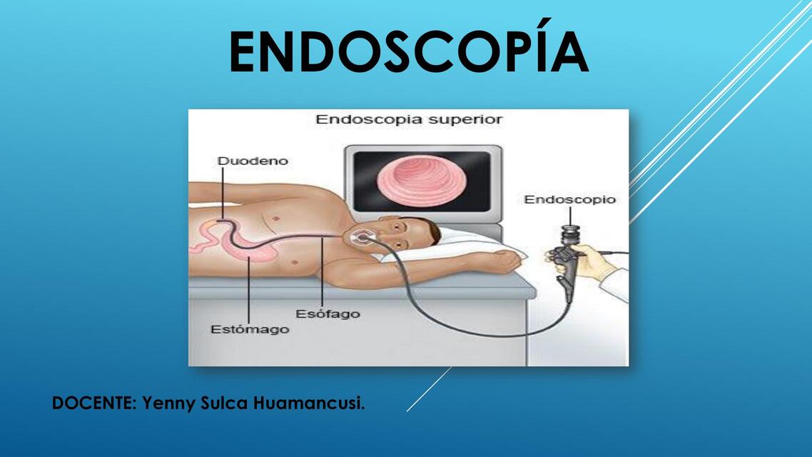 ENDOSCOPÍA