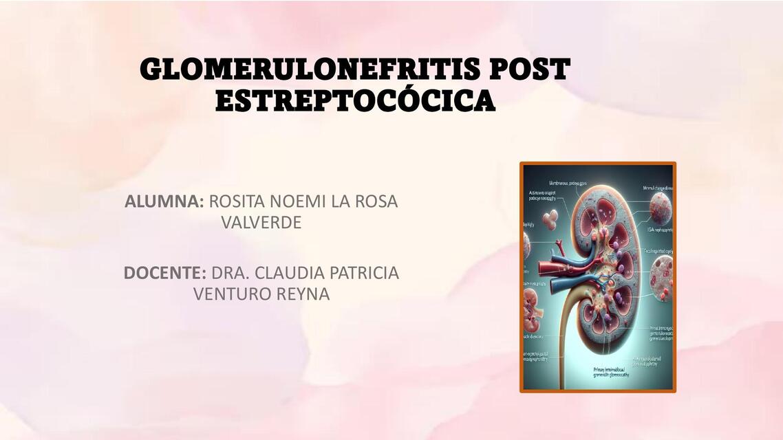 GLOMERULONEFRITIS POST ESTREPTOCÓCICA