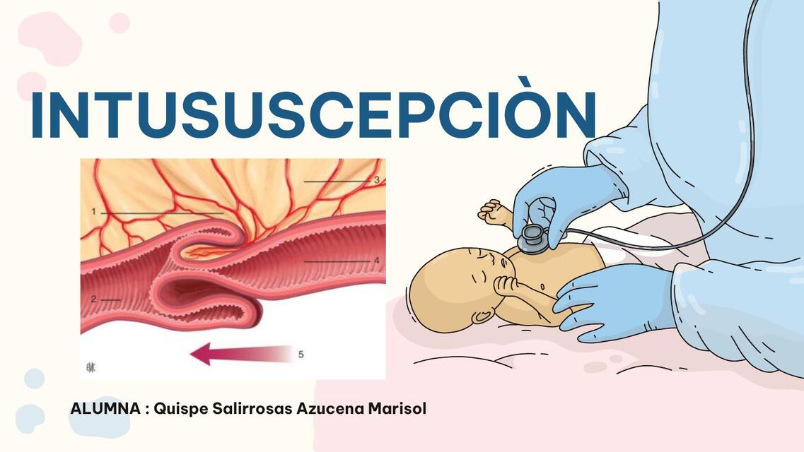 INTUSUSCEPCIN emergencias pptx