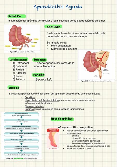 Apendicitis Aguda