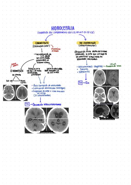 HIDROCEFALIA (CLASIFICACIÓN)