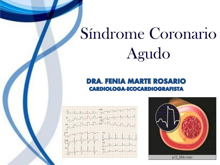 Curso Cardiopatía Isquémica