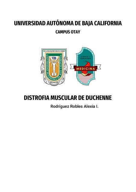 Resumen de Distrofia muscular de Duchenne 