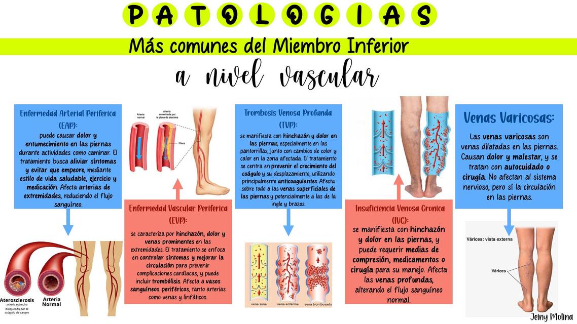 Enfermedades Miembro Inferior