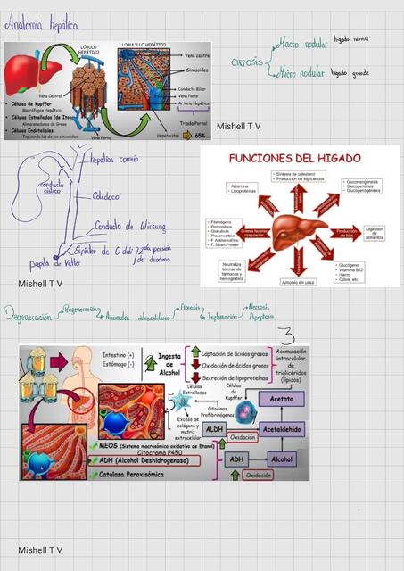 Cirrosis