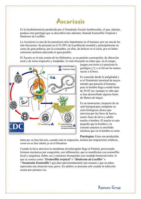 Ascariosis