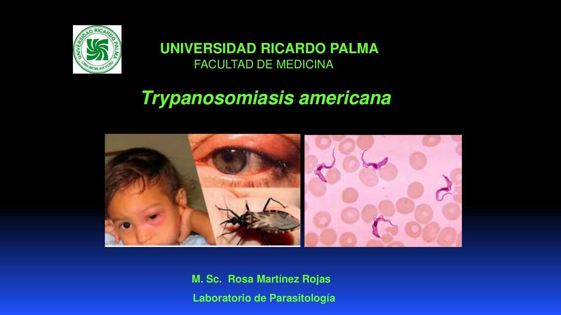 Clase 7a TRIPANOSOMIASIS AMERICANA