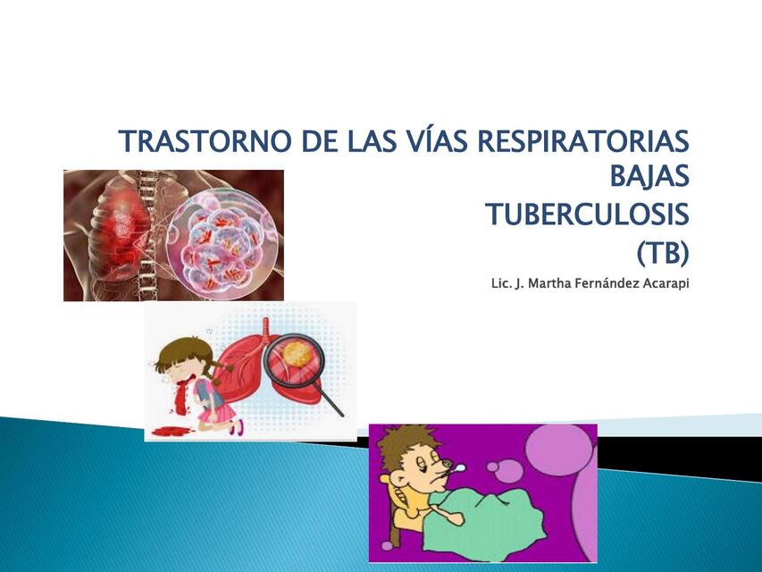 1 PRESENTACION TUBERCULOSIS TB