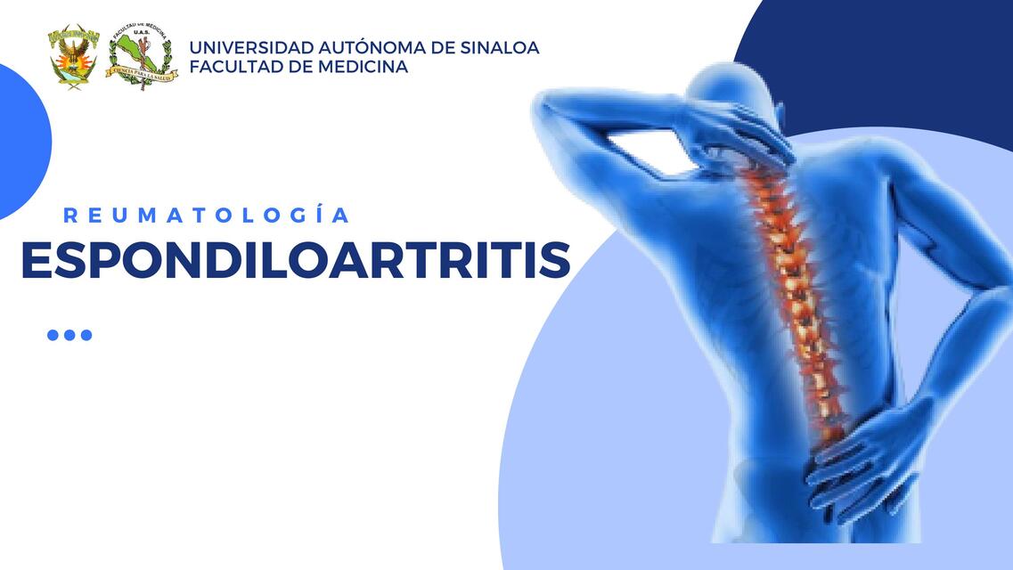 Espondiloartritis Reumatologia