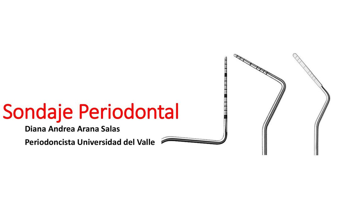 sondaje periodontal