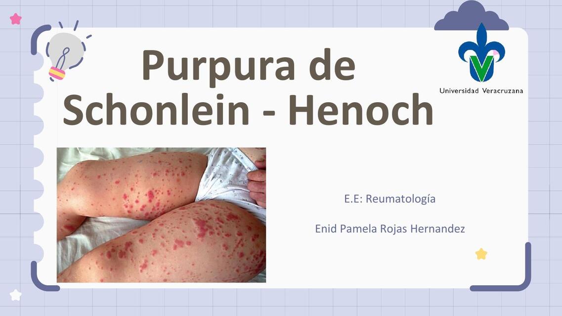 vasculitis Purpura de henoch schonlein