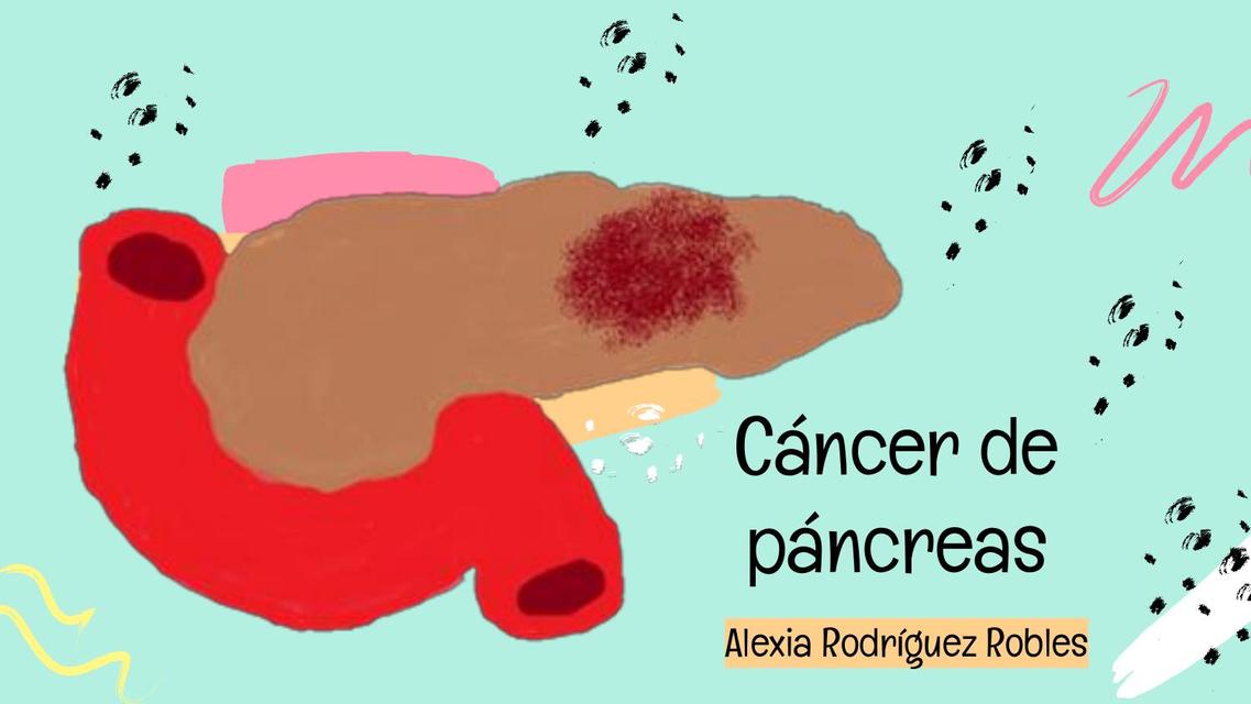 Cáncer de pancreas