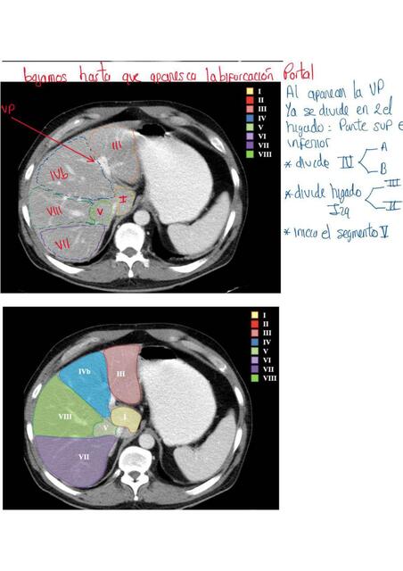 SEGMENTACIÓN HEPÁTICA 7