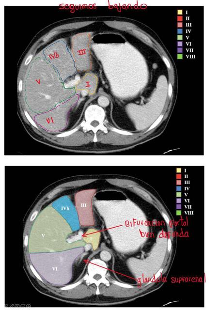 SEGMENTACIÓN HEPÁTICA 9