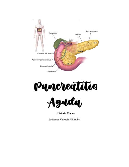 Pancreatitis Aguda + caso clínico