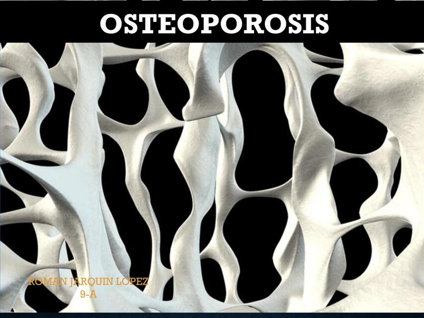 osteoporosis