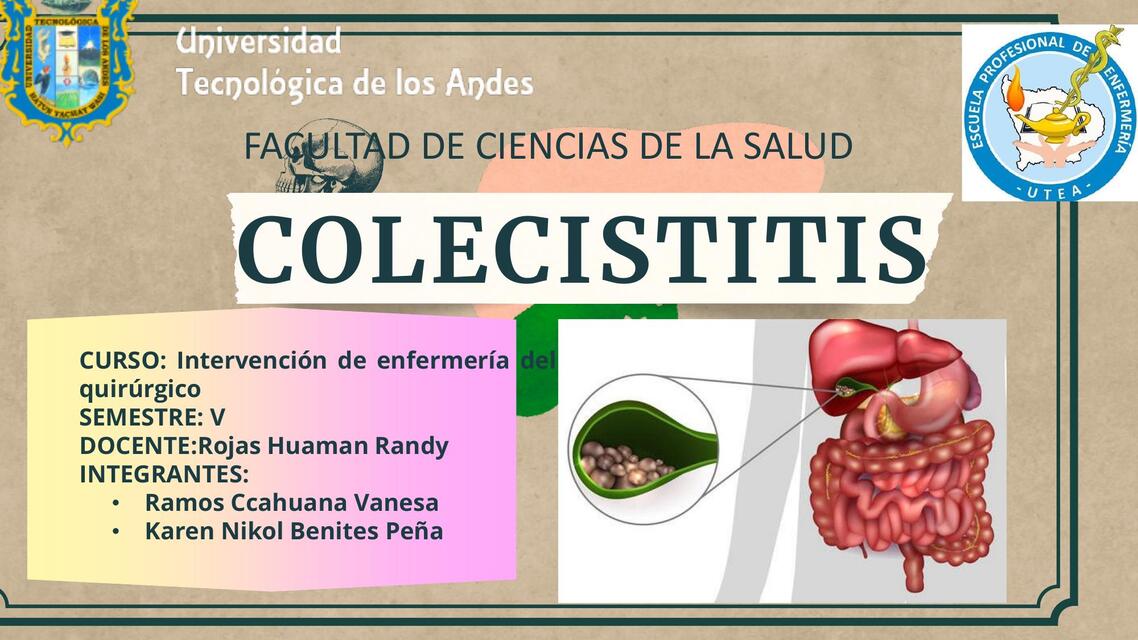 colecistitis