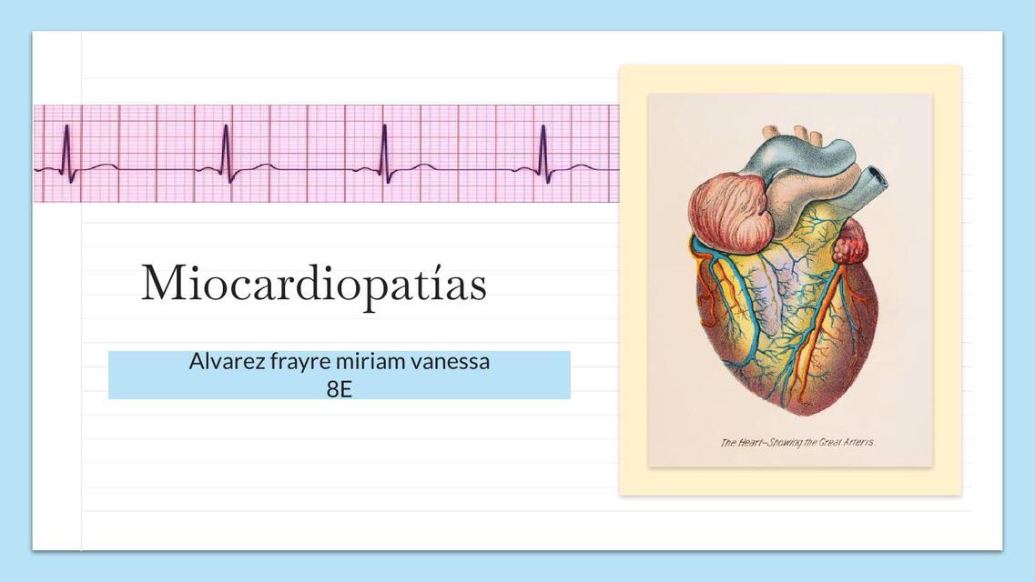 Miocardiopatias