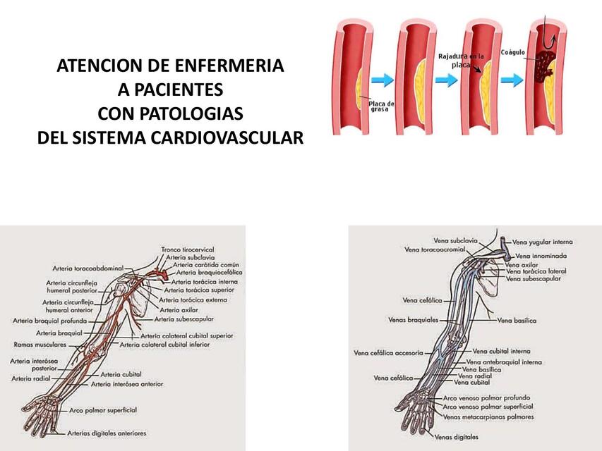 Patologias cardiovasculares