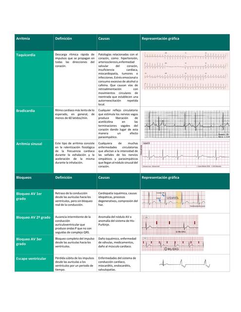 ARRITMIAS CARDIACAS