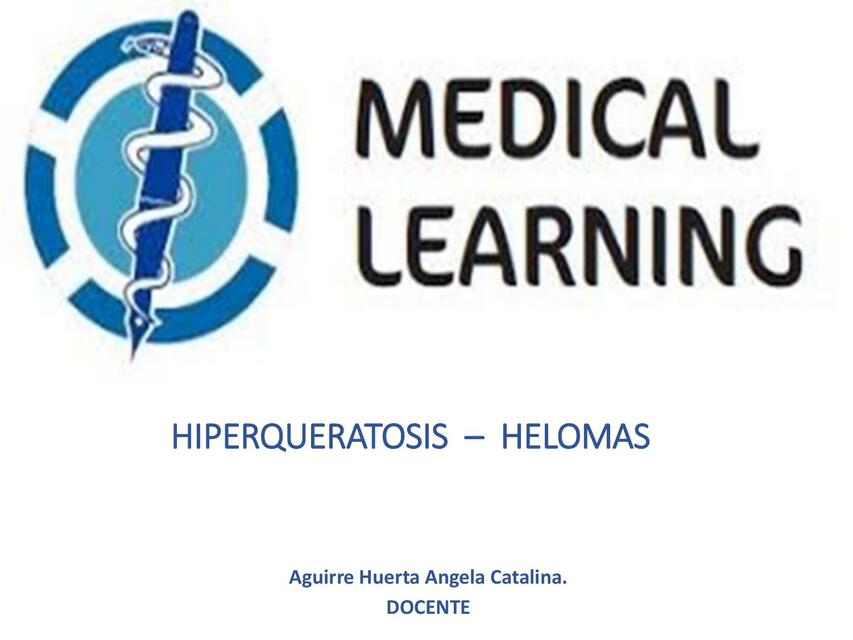 HIPERQUERATOSIS HELOMAS wecompress com