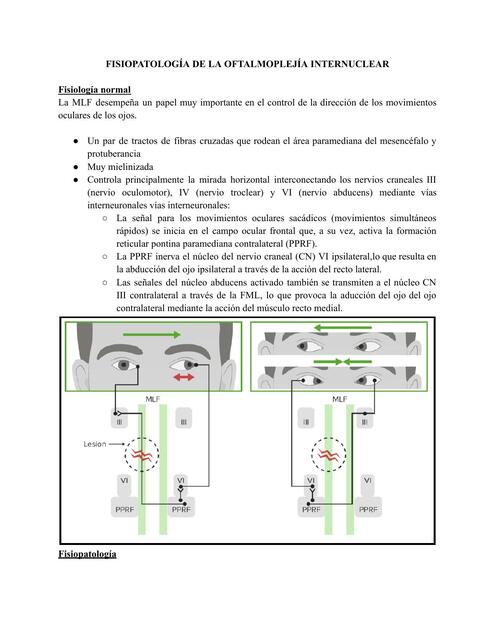 Fisiopatología de la Oftalmoplejía internuclear