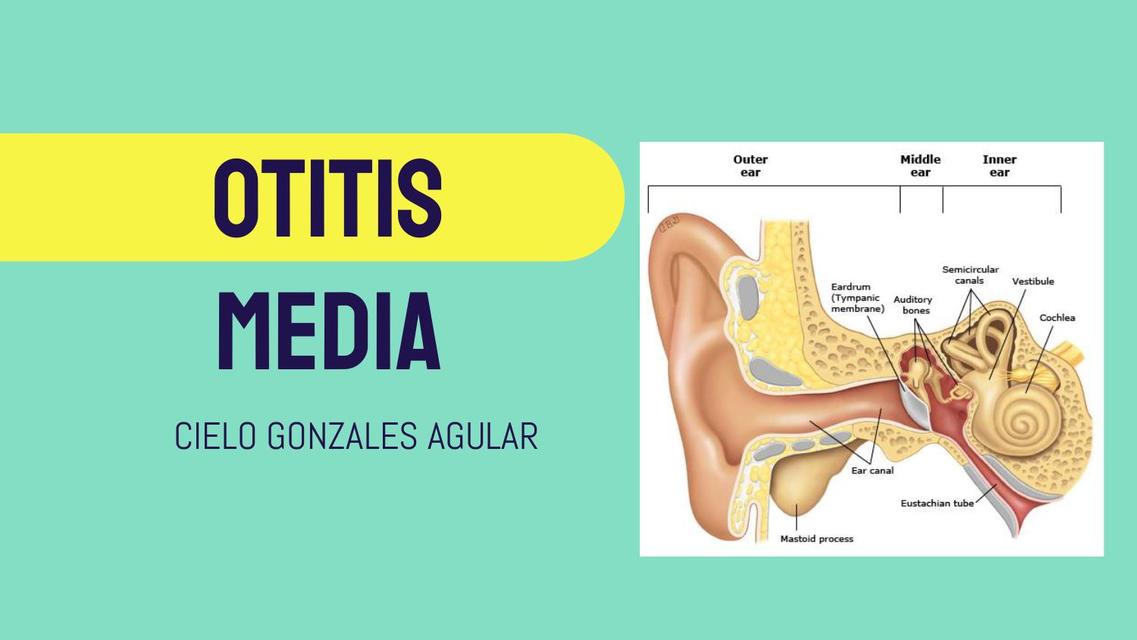 OTITIS MEDIA ABP 2 CIELO