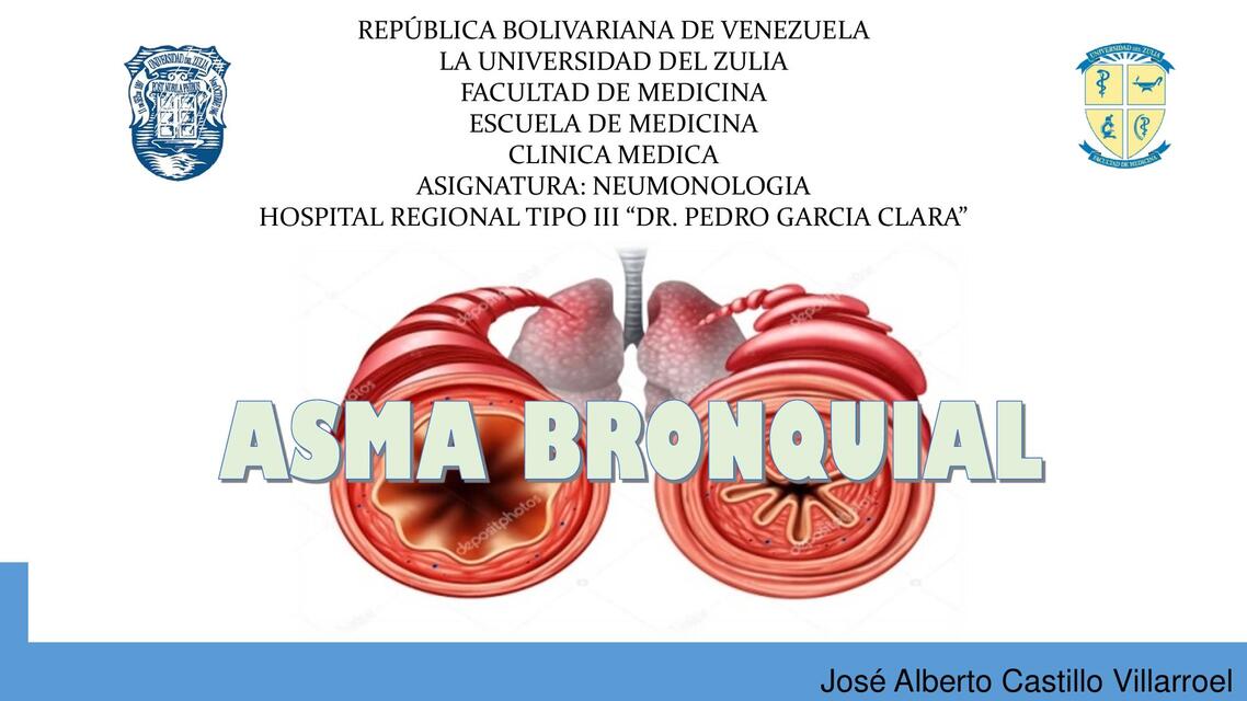 ASMA BRONQUIAL