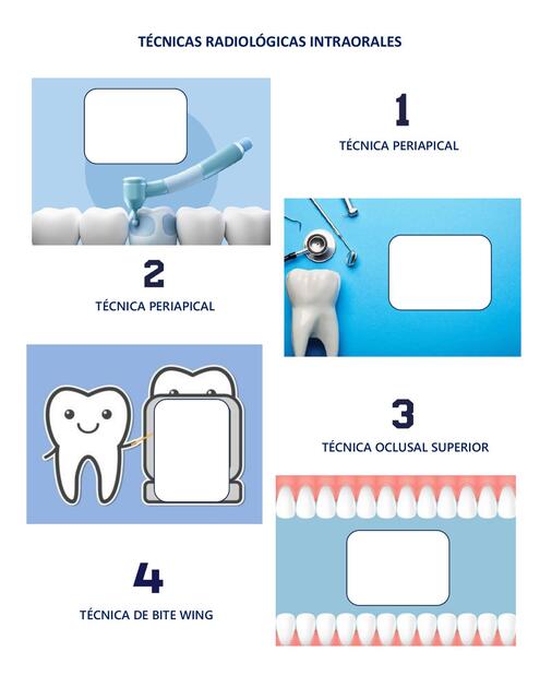 TÉCNICAS RADIOLÓGICAS INTRAORALES